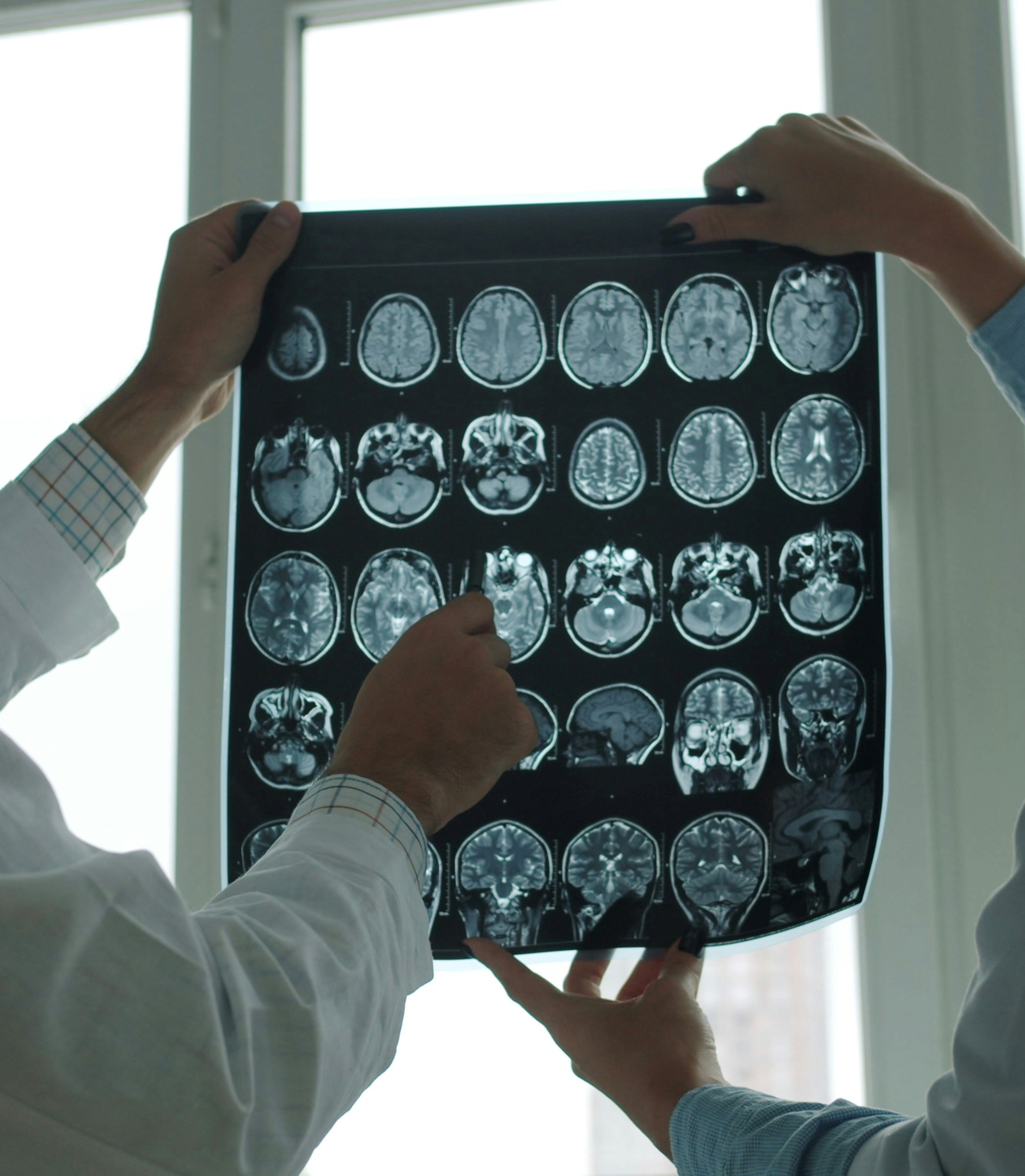 Brain scan